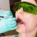 lady getting laser dentist treatment