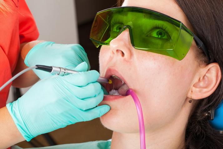 Why Lasers are the Latest Space-Age Dentistry Breakthrough