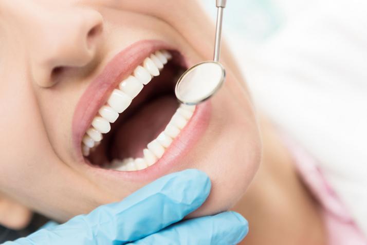 How DIAGNOdent Helps Dentists Detect and Diagnose Decay