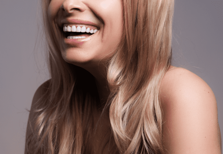 Are Dental Veneers Right for You