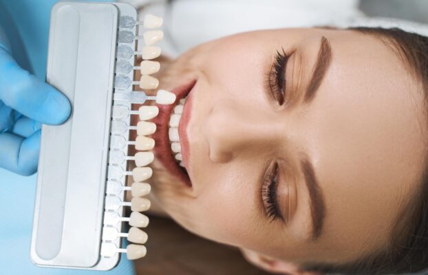Why Teeth Whitening Should Be Done In A Clinic