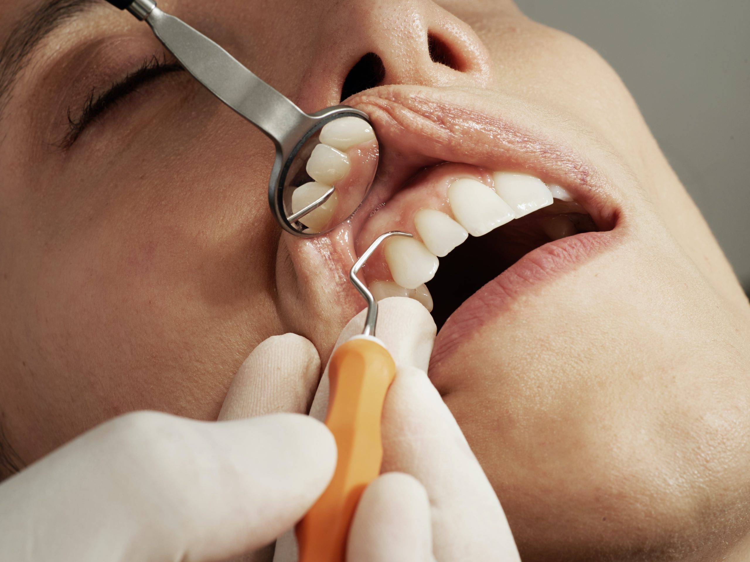 achieve a perfect smile with cosmetic dentistry 4 scaled