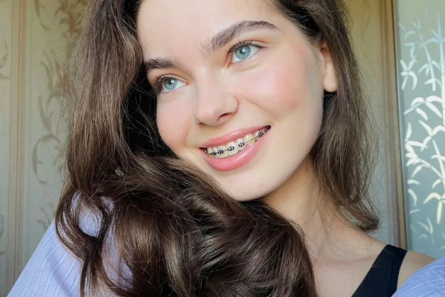 Why Do Some People Need Elastics with Dental Braces?