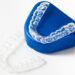 Clear Aligners