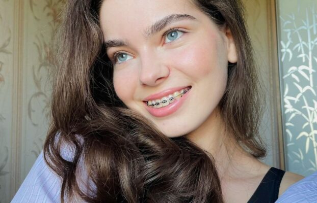Why Do Some People Need Elastics with Dental Braces?
