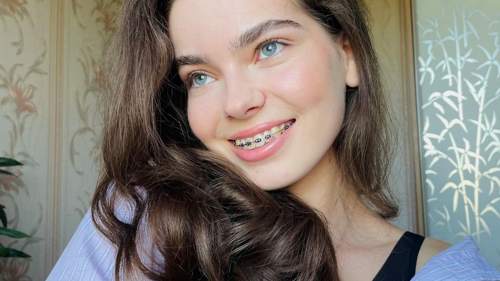 Why Do Some People Need Elastics with Dental Braces?