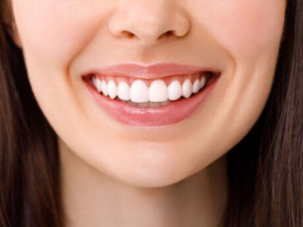 Teeth Whitening